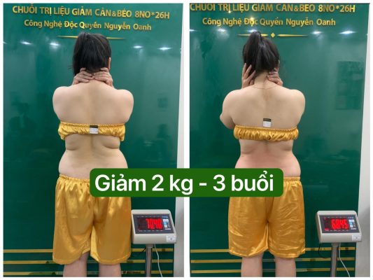 Quy trình giảm béo tại Tuyên Quang được thực hiện như thế nào?