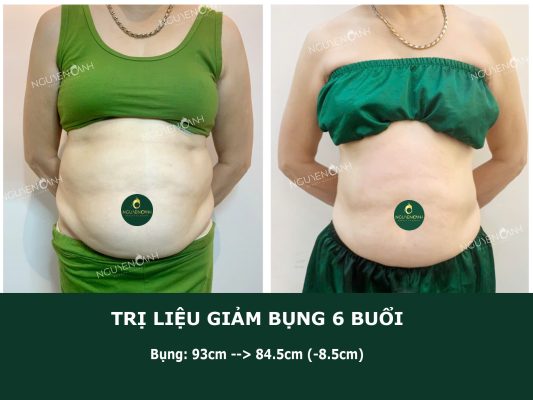 Thẩm mỹ Nguyễn Oanh - Địa chỉ giảm béo uy tín Tuyên Quang