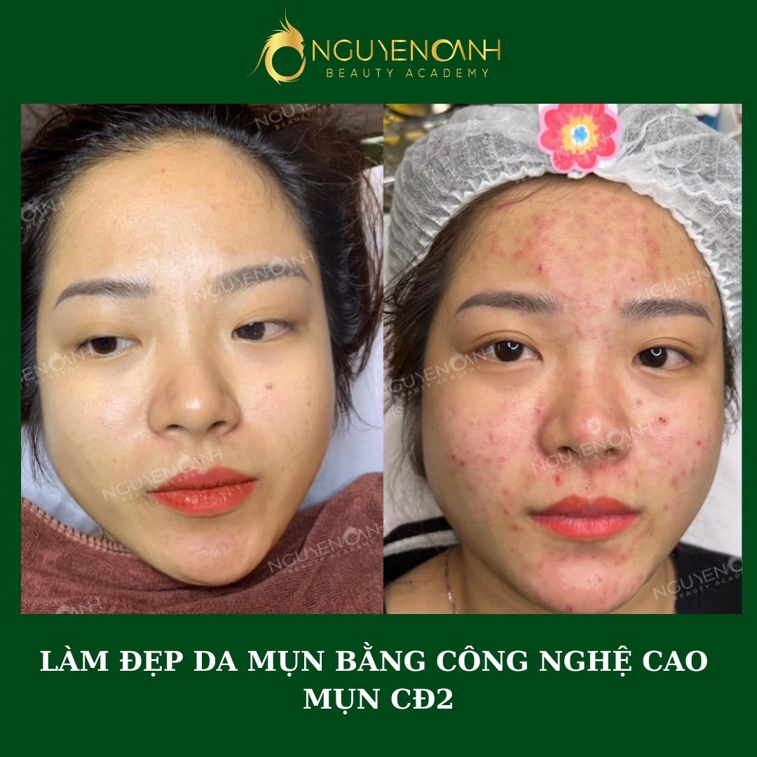 Các dịch vụ spa chăm sóc da Tuyên Quang hiện nay