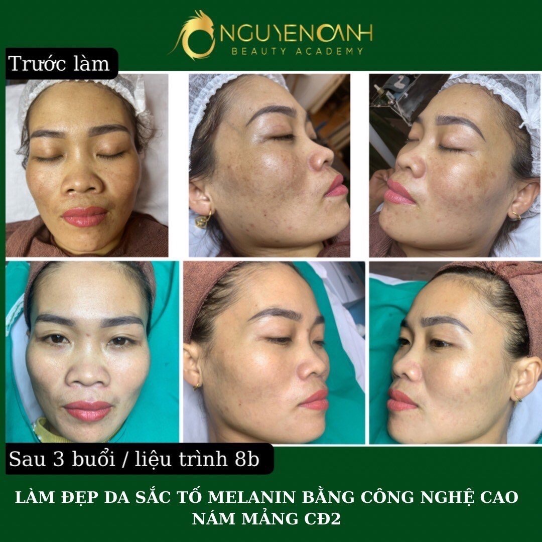 Dịch vụ spa chăm sóc da Tuyên Quang uy tín nhất 2024