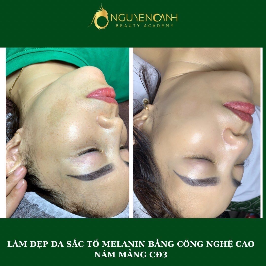 Lợi ích của dịch vụ spa chăm sóc da Tuyên Quang uy tín