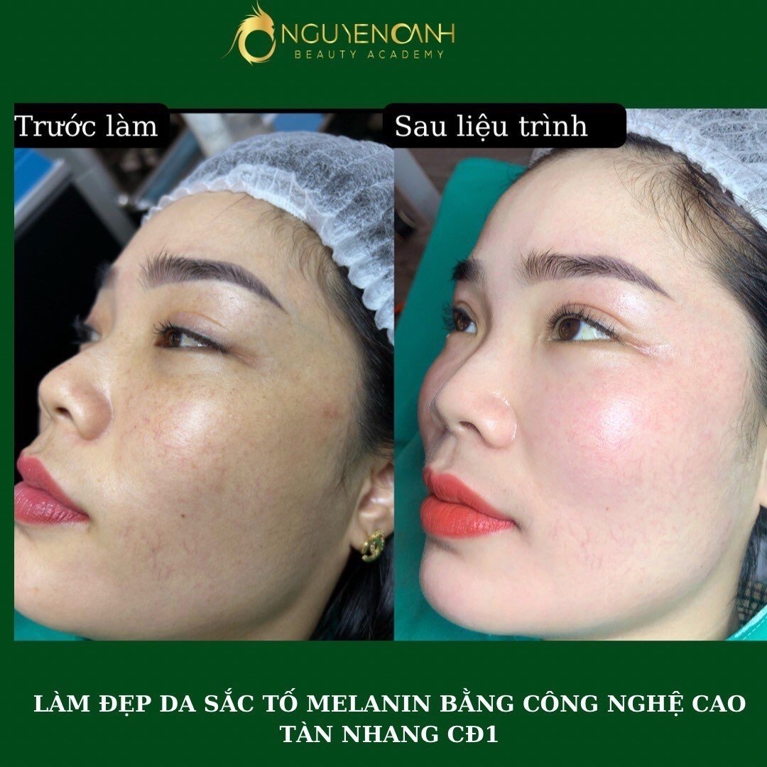 Các dịch vụ spa làm đẹp tại Tuyên Quang được ưa chuộng hiện nay